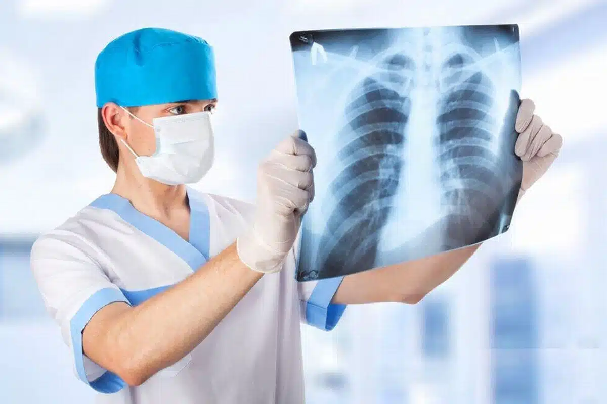 Рентгеновский снимок больного пневмонией фото