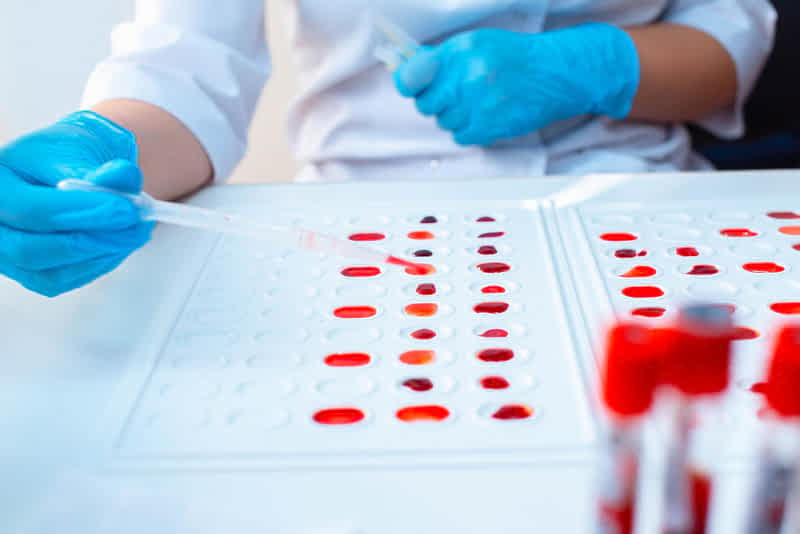 Как наследуется группа крови, и когда ребенок может получить «чужую кровь»: объяснение ученых