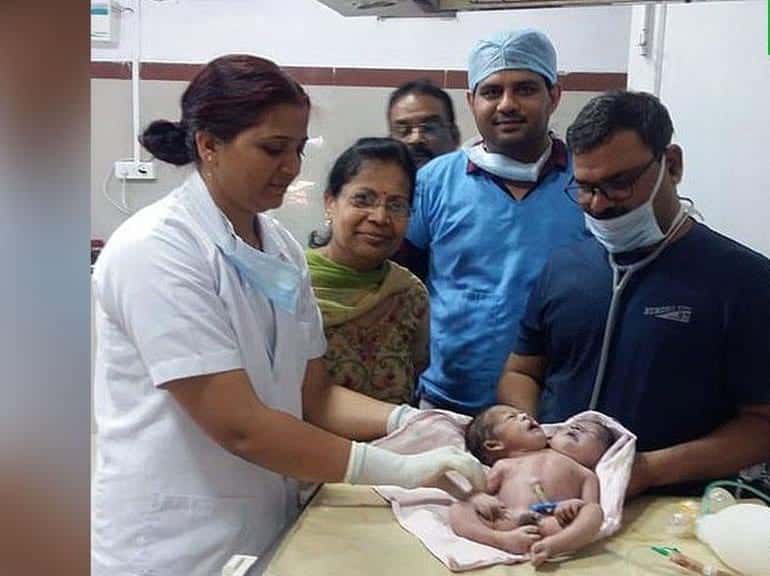 В Мьянме родился двухголовый ребенок - Cursorinfo: главные новости Израиля