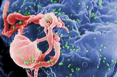 Клетки ВИЧ фото