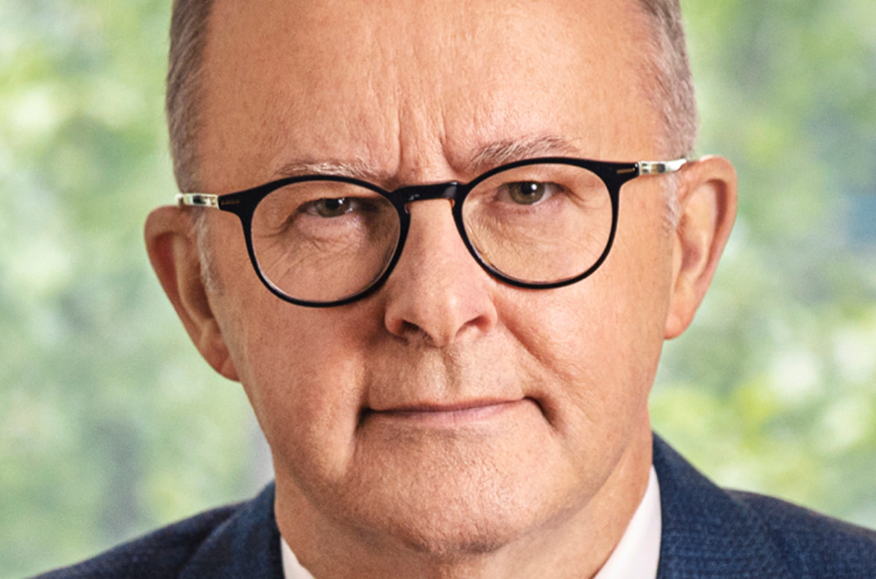 Энтони Албаниз фото